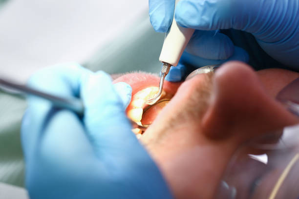 Best Broken or Chipped Tooth Repair in Church Hill, MD