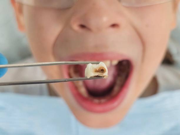 Best Emergency Denture Repair in Church Hill, MD